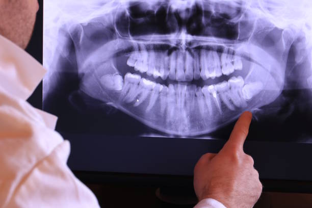Best Emergency Tooth Extraction in Greenville, AL