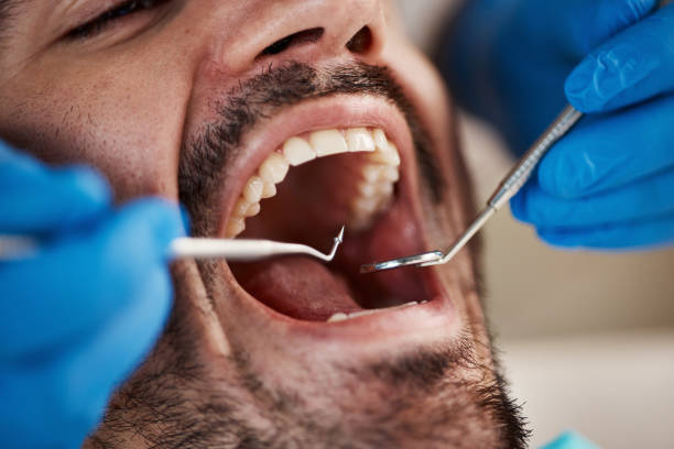 Best Emergency Tooth Extraction in Greenville, AL
