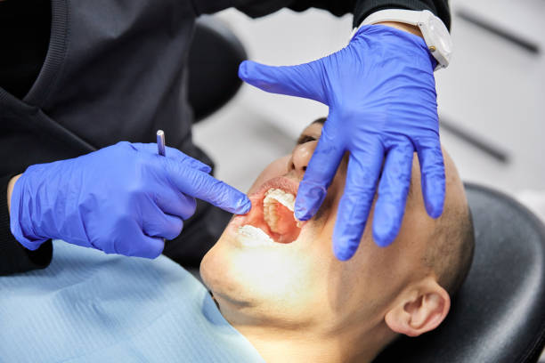 Best Emergency Root Canal Treatment in Greenville, AL